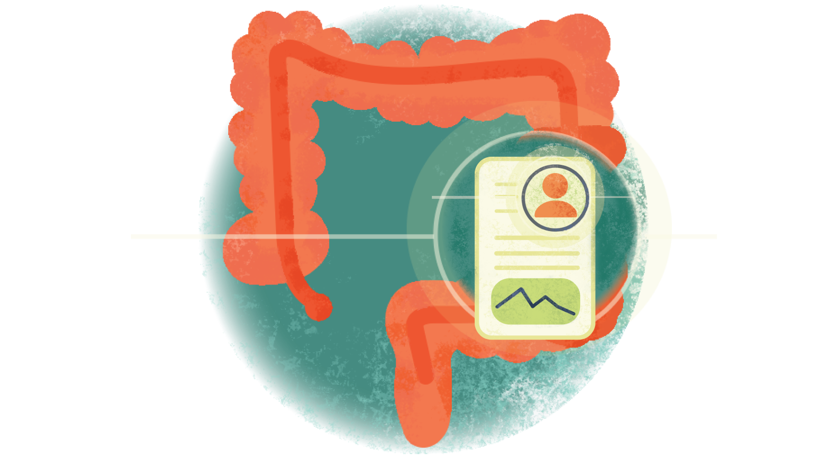 Illustration of written case study over a colon with ulcerative colitis 